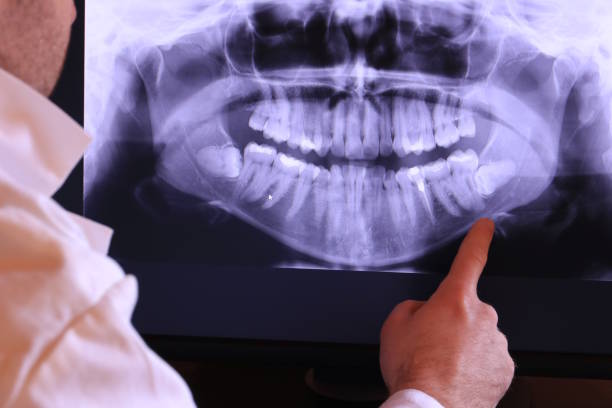 Best Walk-In Emergency Dental Services in Montague, CA